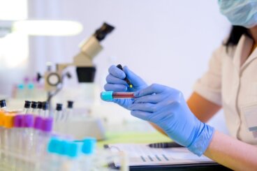 Υψηλό ή χαμηλό RDW στην αιματολογική μέτρηση: Τι σημαίνει;